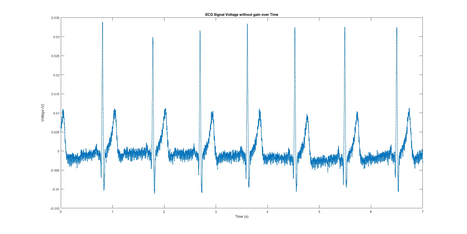 ecg