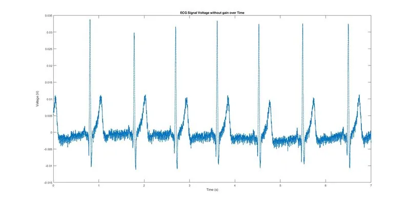 ECG project